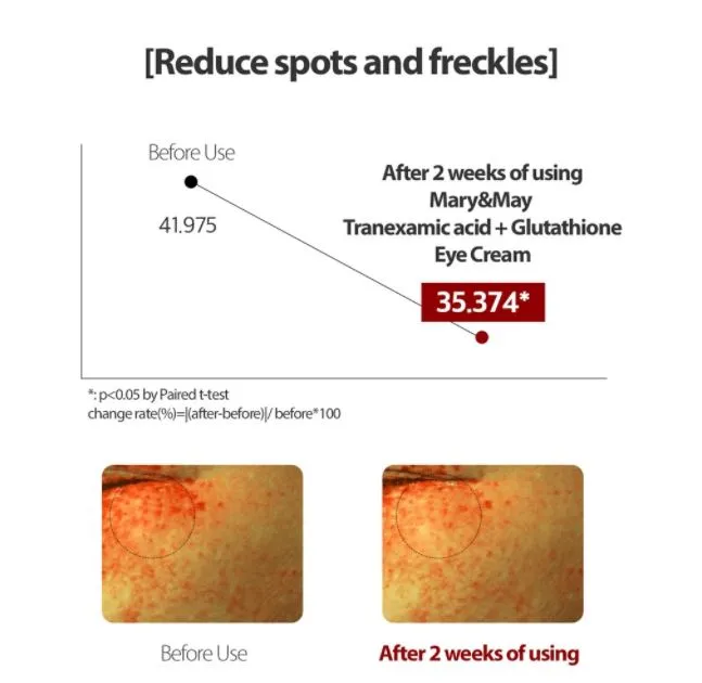 Mary & May Tranexamic Acid and Glutathione Eye Cream